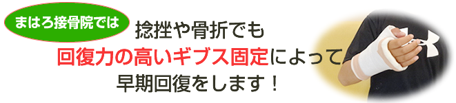 リカラボ接骨院では、捻挫や骨折でも回復力の高いギブス固定によって早期回復をします